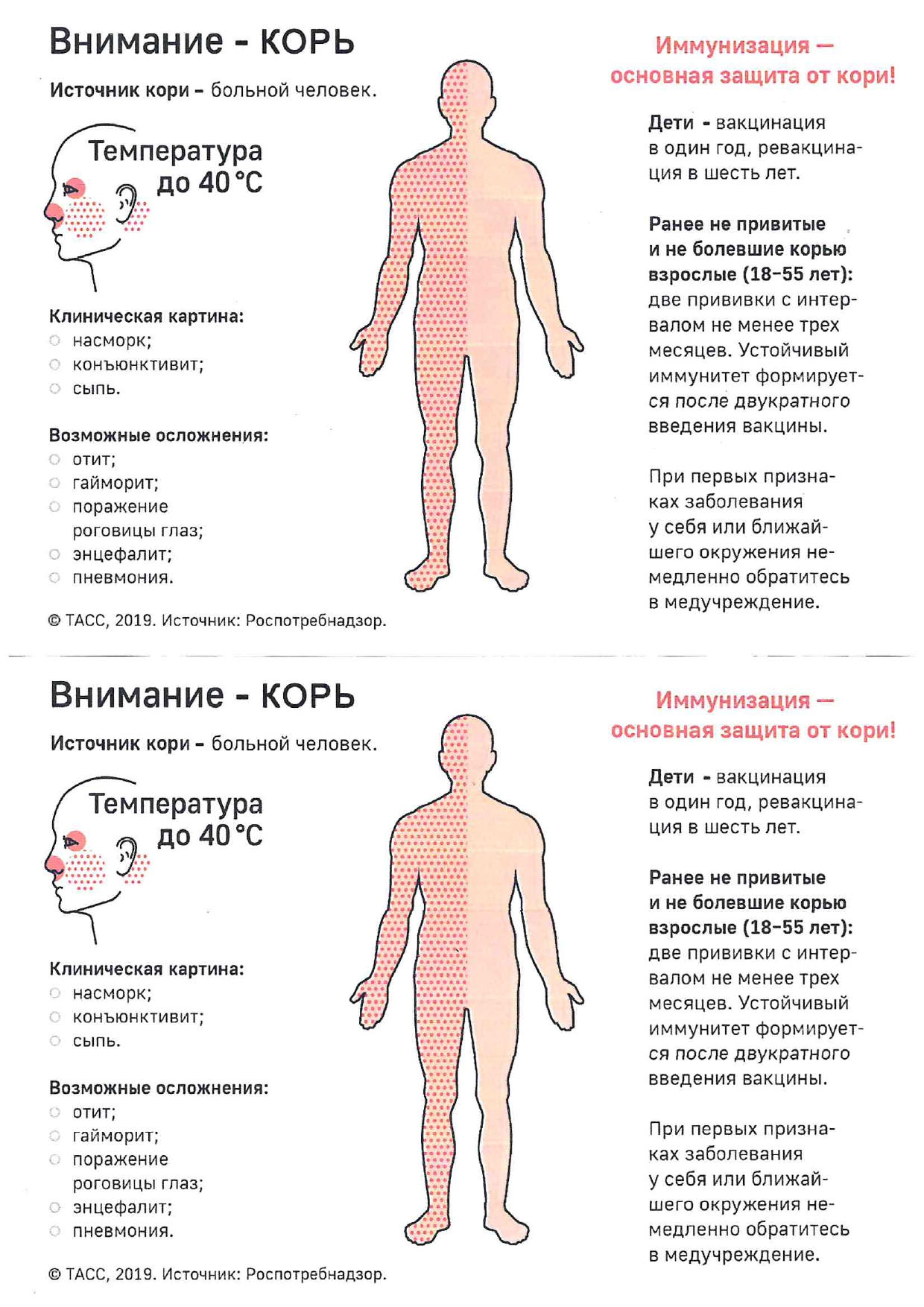 Симптомы кори 2023